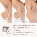 IPL sin cable Philips Lumea 9000 3